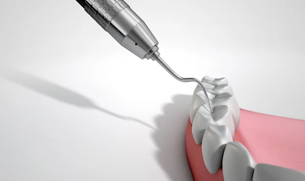 Diş hekimleri sonda kanca ve diş — Stok fotoğraf