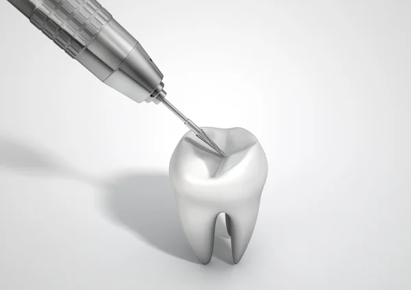 歯科医のドリルと歯 — ストック写真