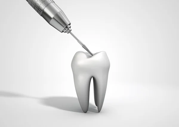 Perceuse et dentiste — Photo