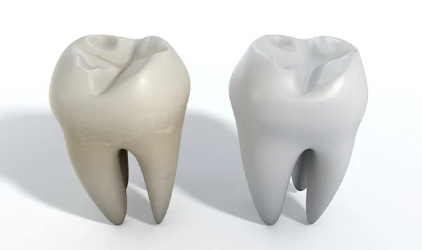 Piszkos tiszta fogak összehasonlítása — Stock Fotó