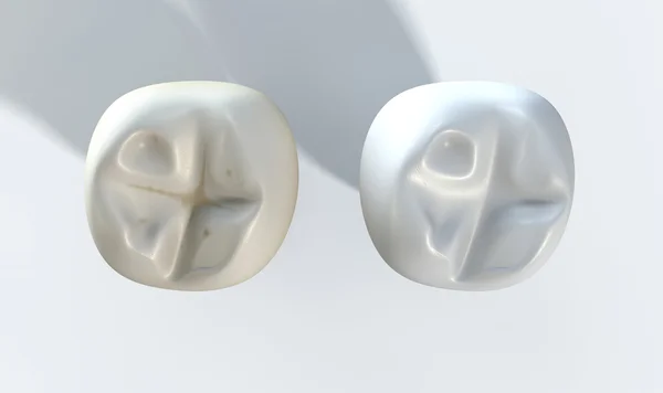 Comparación de dientes sucios limpios —  Fotos de Stock