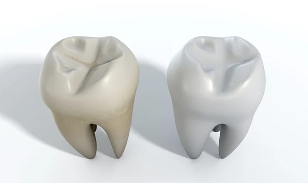 Piszkos tiszta fogak összehasonlítása — Stock Fotó