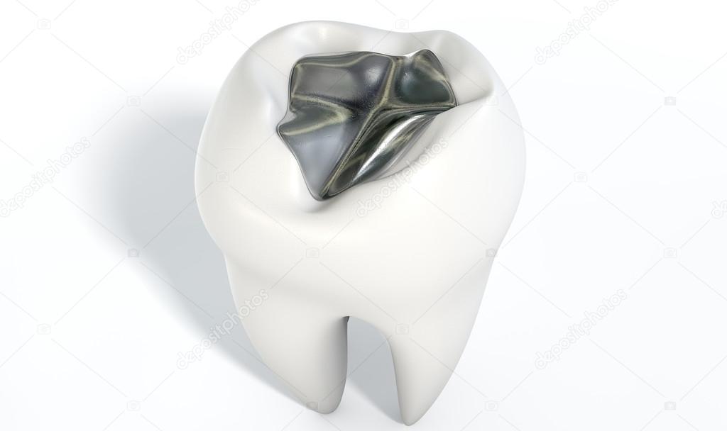 Tooth With Lead Filling