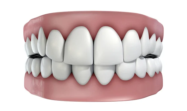 Set di denti isolato — Foto Stock
