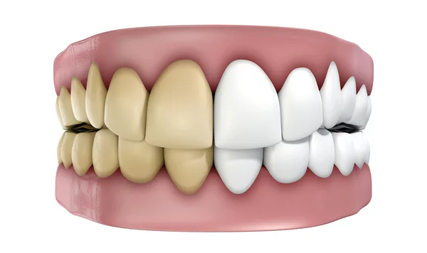 Set di denti isolato — Foto Stock