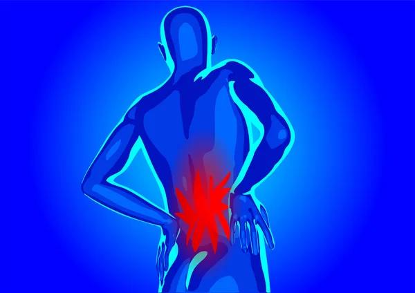 Schmerzen im unteren Rückenbereich — Stockvektor