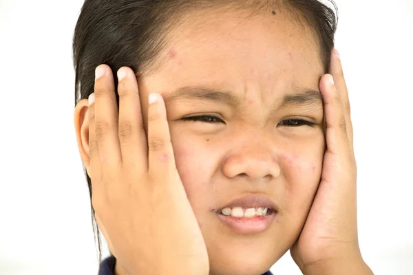 Dama a infeliz con varicela en la cara — Foto de Stock