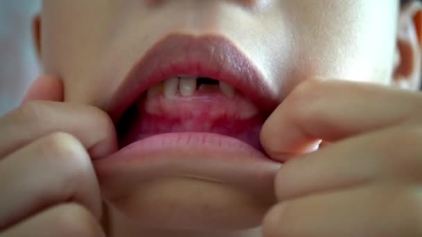 关起一个中国小孩的牙齿 — 图库视频影像