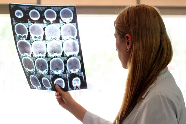 Médico Neurología Femenina Vestido Revisando Imágenes Cerebrales — Foto de Stock