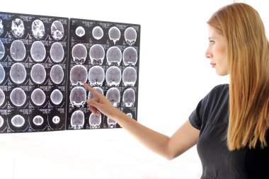 Kadın nörolog kafa tomografisini inceliyor ve hastanede maskeyle çalışıyor.