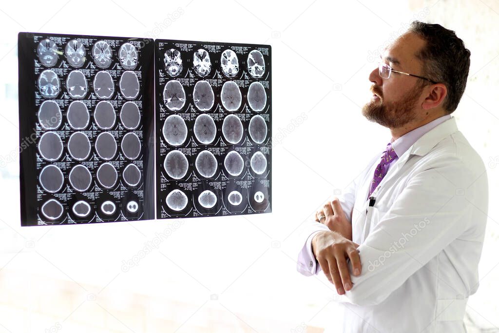 Elegant, light-eyed mature medical man with beard, mustache and glasses, analyzing x-ray brain scans