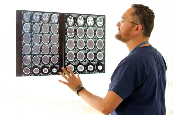 Médico Especialista Neurología Joven Gafas Barba Analizando Escáneres Cerebrales Rayos — Foto de Stock