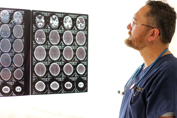 Médico Especialista Neurología Joven Gafas Barba Analizando Escáneres Cerebrales Rayos — Foto de Stock