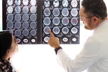 Nöroloji alanında uzman bir doktor ofisinde gözlüklü bir Latin kadına röntgen tomografisini açıklıyor.