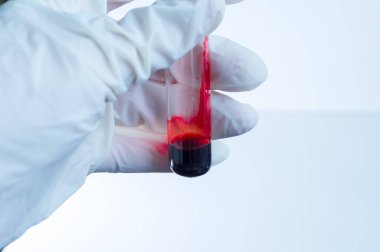 Tıbbi laboratuvar. Eldivenli bir el mavi arka planda bir kan tüpü tutuyor. Bitmap çiziminin elementleri. Yakın plan..