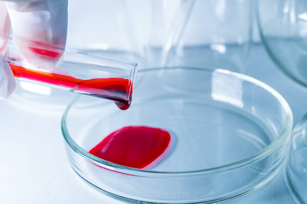 Медицинская лаборатория. Рука в медицинской перчатке проливает кровь в чашку Петри для анализа. Лабораторные испытания. Крупный план.