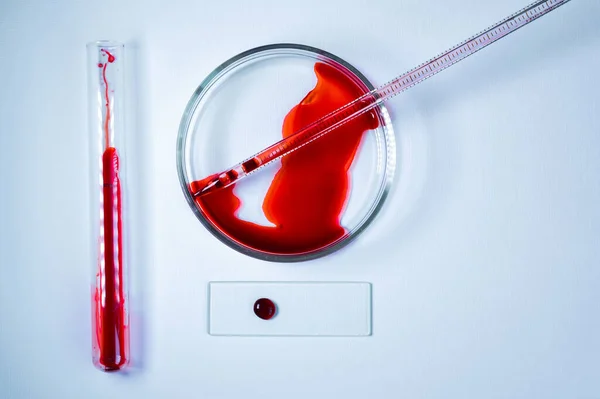 Medical laboratory. A test tube and a Petri dish with blood on a white background. The concept of laboratory research. Close-up.
