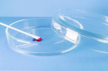 Tıbbi laboratuvar. Mavi arka planda, petri kabında kan olan bir pamuk çubuğu. Laboratuvar araştırması konsepti. Coronavirus testi. Yakın plan..