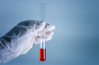 Tıbbi laboratuvar. Mavi arka planda, elinde kan olan bir test tüpü. Laboratuvar araştırması konsepti. Yakın plan..