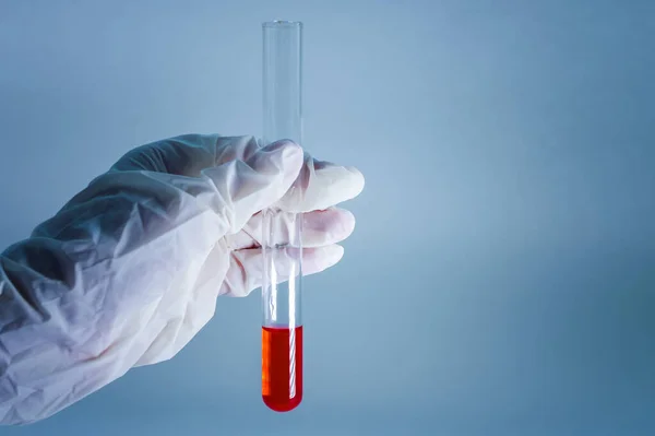 医学研究所 青い背景の医療用手袋に手に血液を持つ試験管 実験室研究の概念 — ストック写真