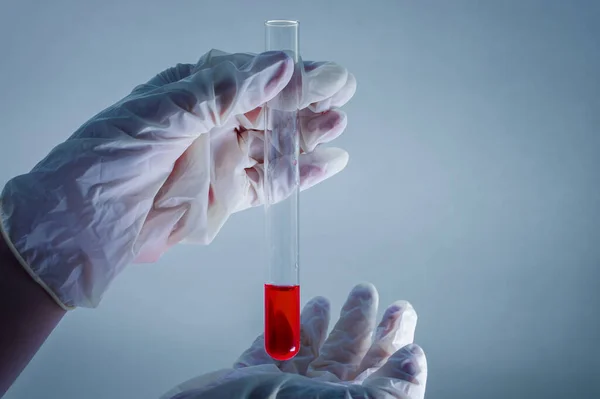 Laboratorio Médico Tubo Ensayo Con Sangre Mano Guante Médico Sobre —  Fotos de Stock