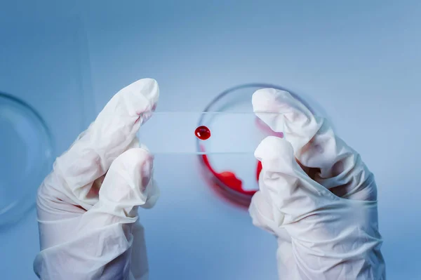 医学研究所 青い背景の医療用手袋に手に血が付いているガラス板 実験室研究の概念 — ストック写真