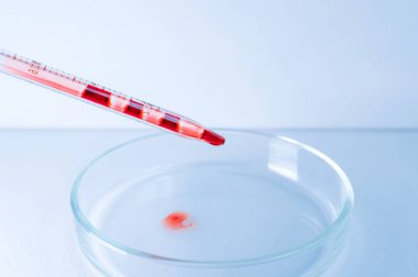Tıbbi laboratuvar. Pipetteki kan mavi arka plandaki boş bir petri kabına dökülüyor. Laboratuvar testleri. Yakın plan..