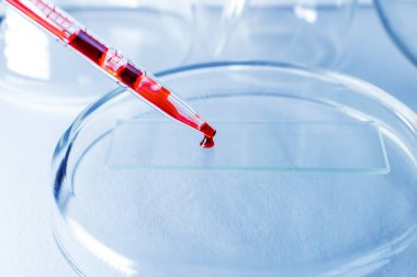 Tıbbi laboratuvar. Pipetteki kan analiz için bir petri kabına dökülüyor. Laboratuvar testleri. Yakın plan..