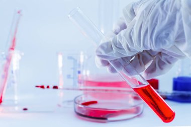 Medical laboratory. A gloved hand holds a test tube of blood on a blue background. The concept of laboratory research. Close-up.
