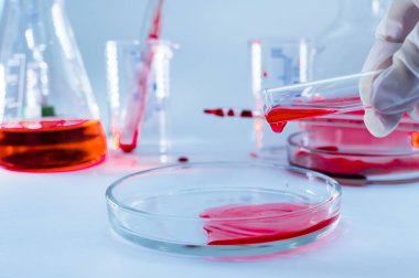 Tıbbi laboratuvar. Tıbbi eldivendeki bir el analiz için petri kabına kan döker. Laboratuvar testleri. Yakın plan..