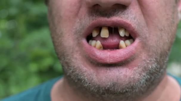 Nahaufnahme Des Mundes Eines Zahnlosen Mannes Bewegt Seine Lippen Und — Stockvideo