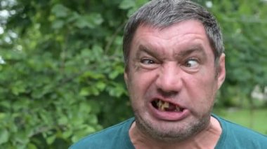 Zihinsel engelli, dişsiz, traşsız bir adam burnunu karıştırıp salyalarını akıtıyor. Akıl hastalığı kavramı. 4k video biçimi.