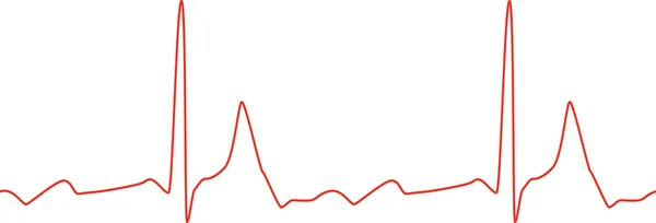 白い背景の上の Sseamless 心電図のグラフ — ストックベクタ