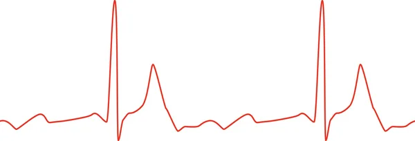 흰색 바탕에 Sseamless 심전도 그래프 — 스톡 벡터