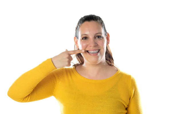 Dorosła Kobieta Aparacie Zębach Żółtej Koszulce Odizolowana Białym Tle — Zdjęcie stockowe