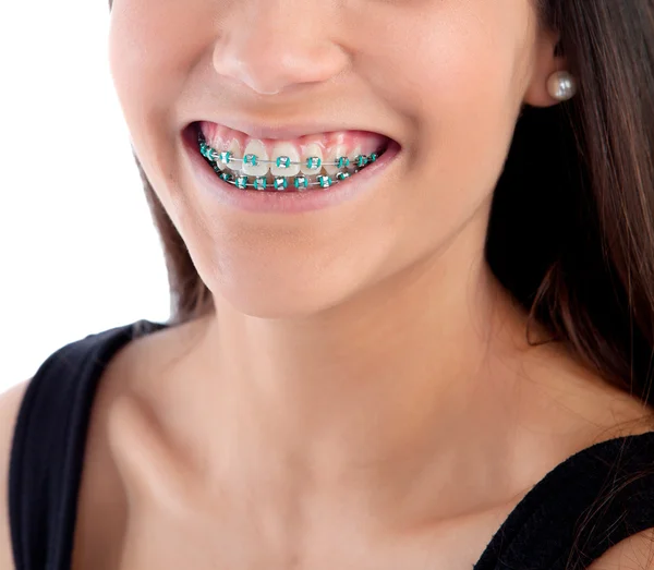 Sonriente chica adolescente con corchetes — Foto de Stock