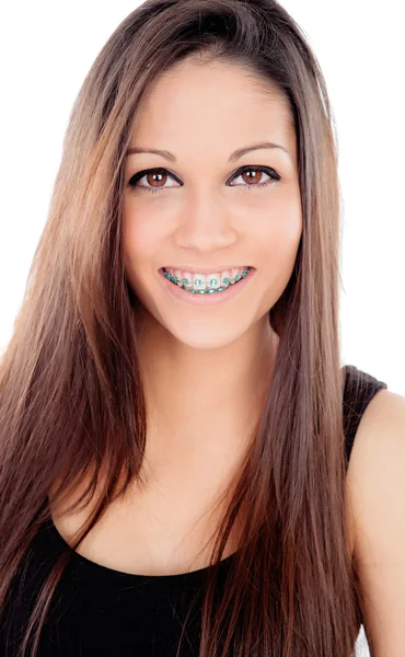 Attractive smiling girl with brackets — Stock Photo, Image