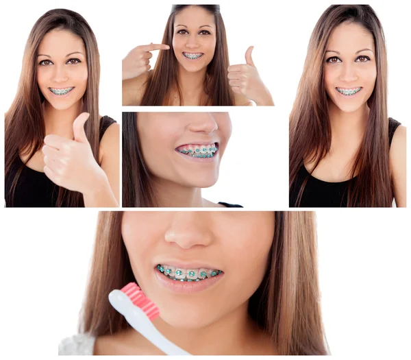 Menina com suportes nos dentes — Fotografia de Stock