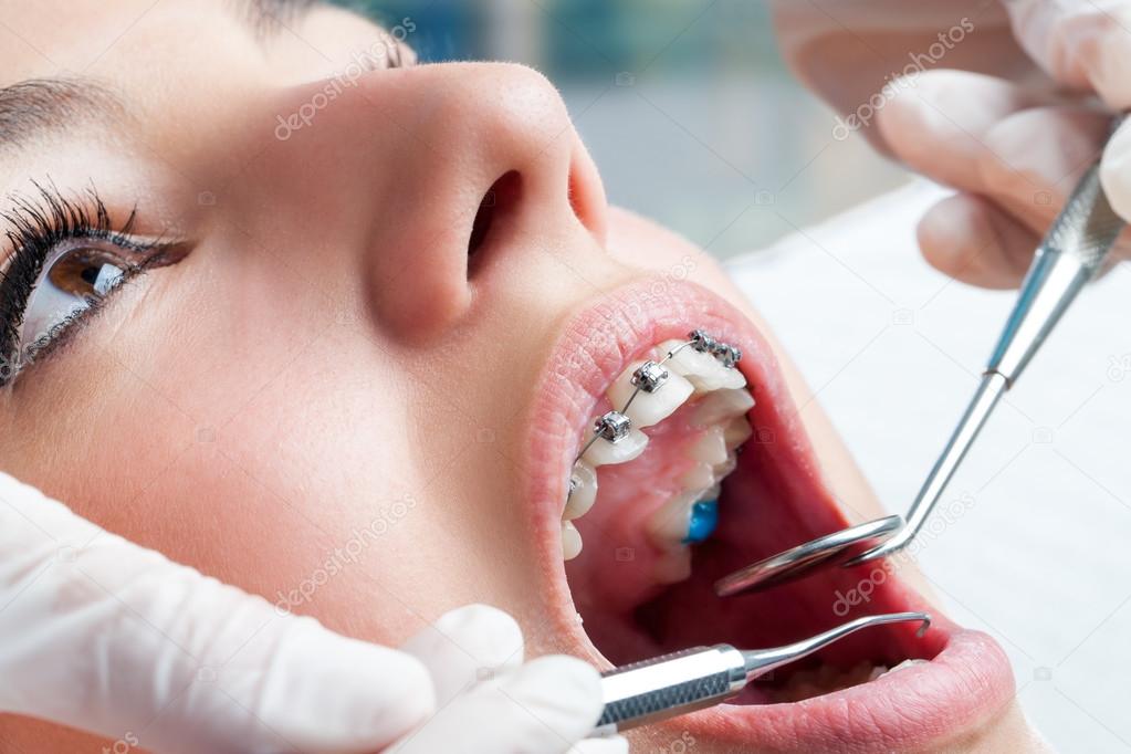 Dentist hands working on dental braces.