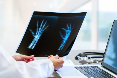 X ışını masa başında holding doktor eller.