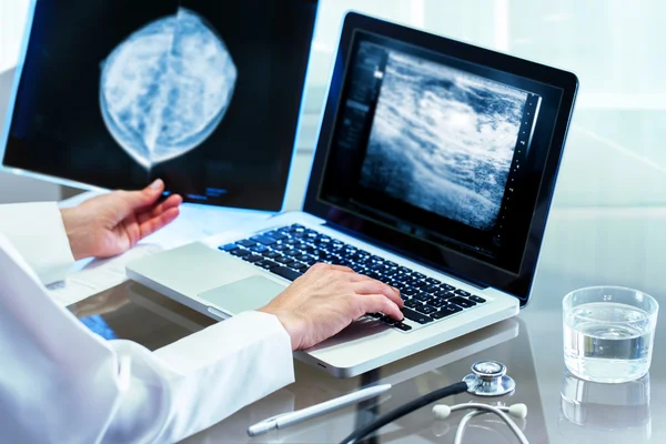 Arts herziening mammografie resultaten op pc. — Stockfoto