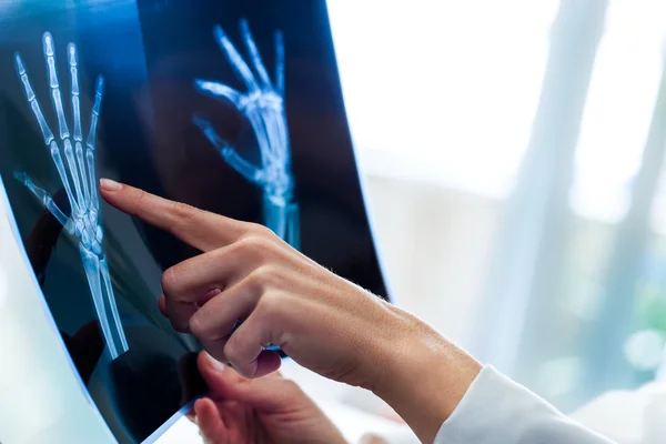 Mão feminina apontando para a folha de raios X . — Fotografia de Stock