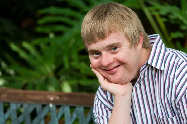 Facial portrait of handicapped boy resting chin on palm of hand. — Stock Photo, Image