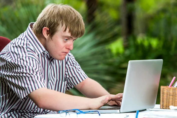 Concentrated handicapped boy typing on laptop. — Stock Photo, Image