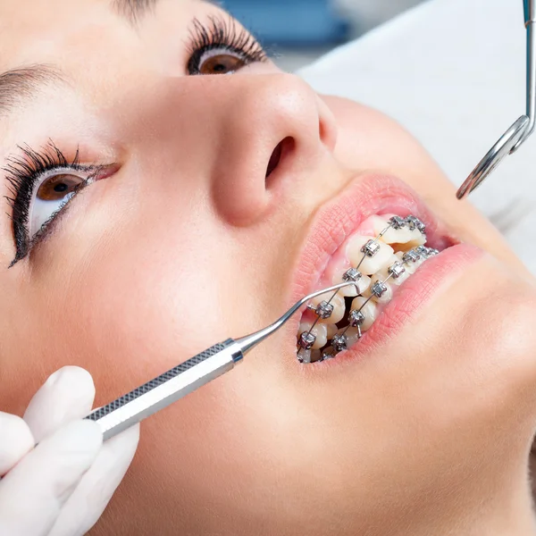 Handen bezig met tandheelkundige accolades. — Stockfoto