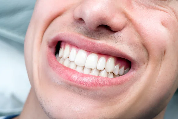 İnsan erkek ağız gösteren dişler — Stok fotoğraf