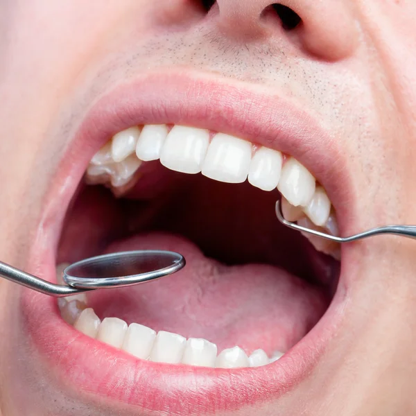 Human male mouth showing teeth — Stock Photo, Image