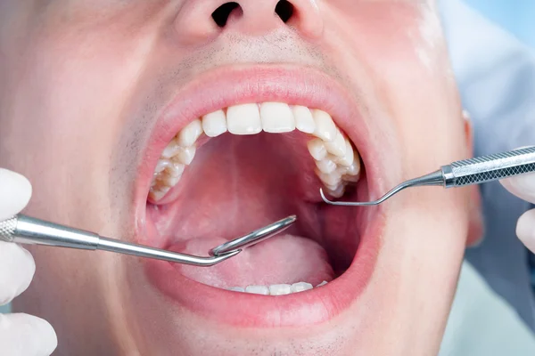 Bocca maschile umana che mostra i denti — Foto Stock