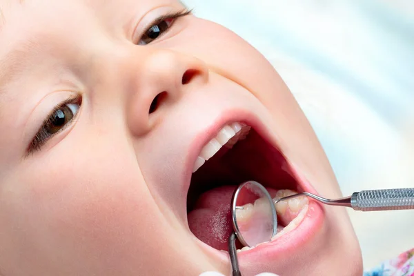 Barn har en dental undersökning. — Stockfoto