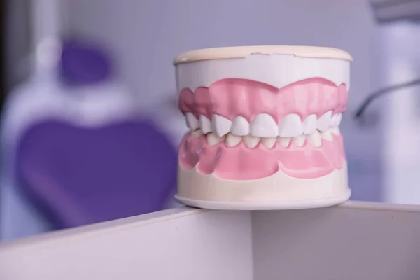 Medische Plastische Prothese Tandheelkundige Kliniek Orthodontische Apparatuur Gezondheidszorgconcept — Stockfoto